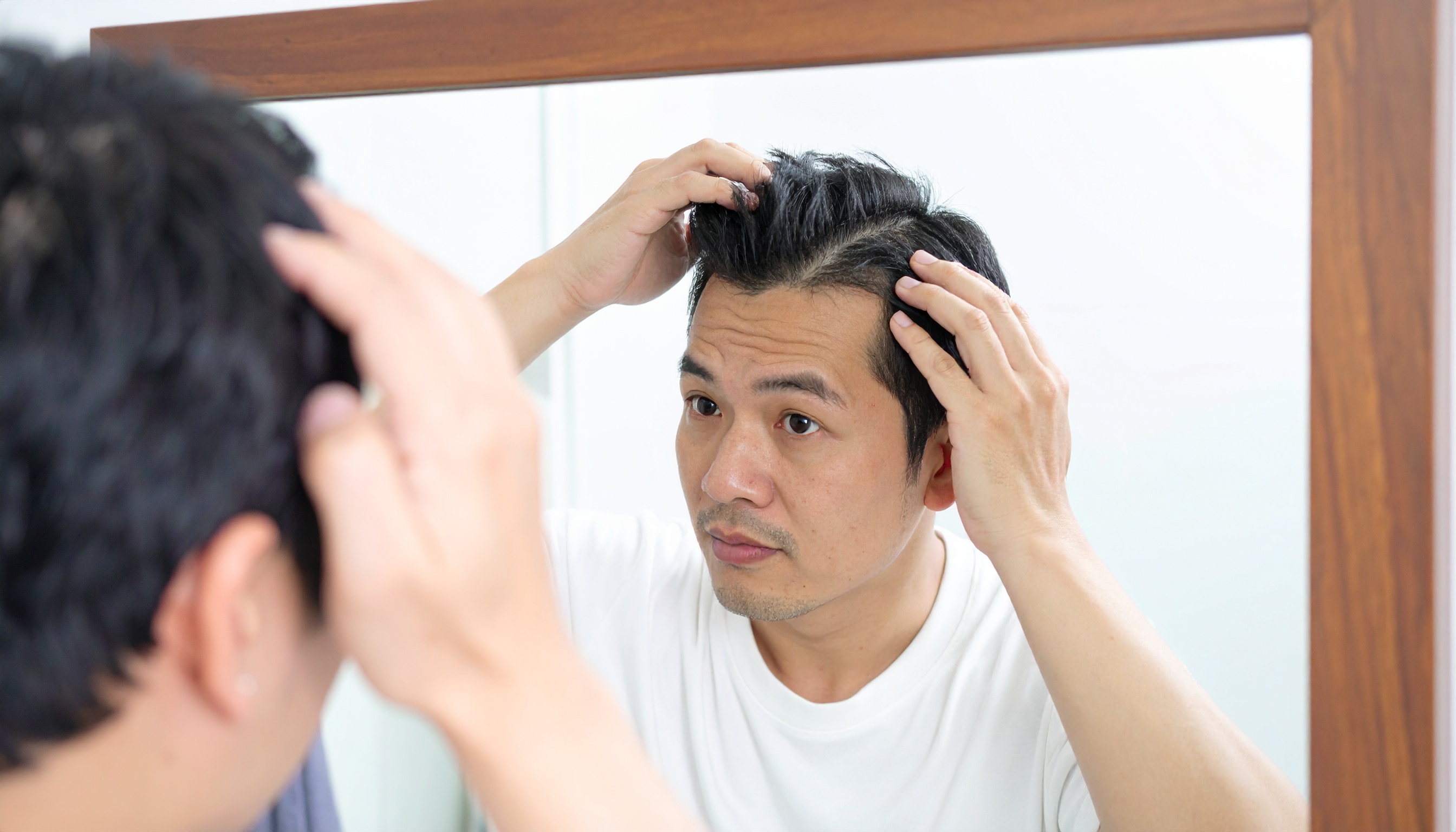 AGA・薄毛対策